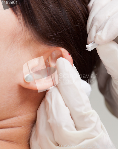 Image of Auricular Acupuncture Detail