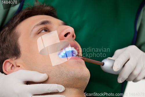 Image of Dentist with UV Light
