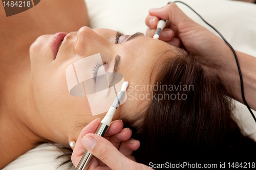 Image of Electro Acupuncture