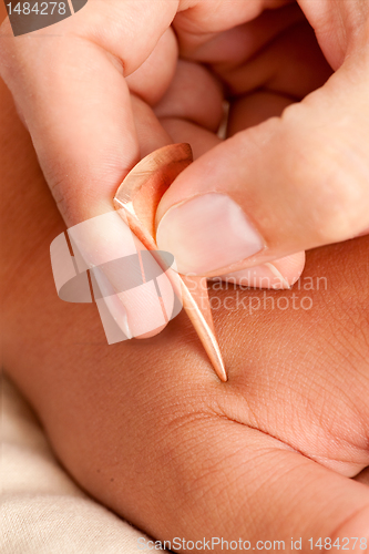 Image of Macro Detail of Yoneyama Acupuncture Tool