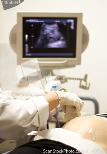 Image of medical examining by ultrasonic scan