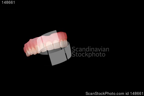 Image of Upper denture 2