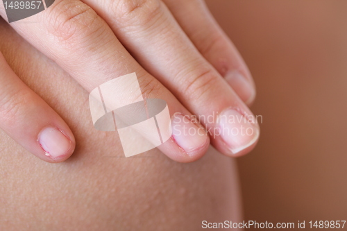 Image of hand and skin