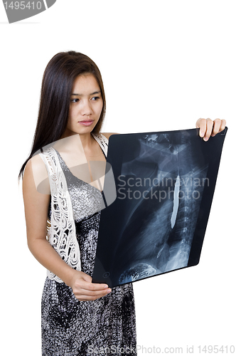 Image of beautiful woman holding an x-ray