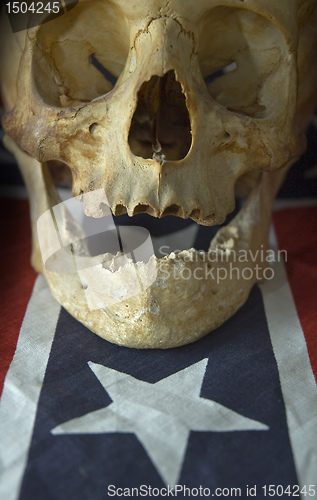 Image of skull detail