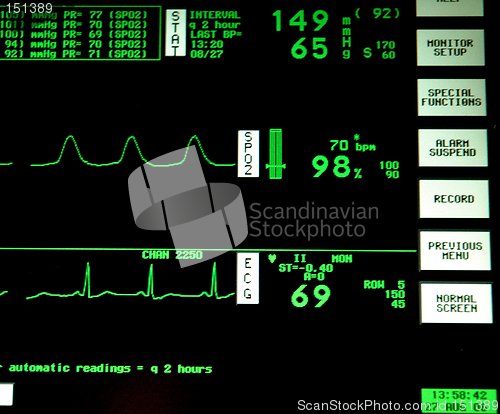 Image of Heart monitor