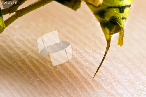 Image of wasp stinging a human