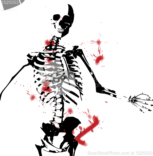 Image of Bloody Skeleton
