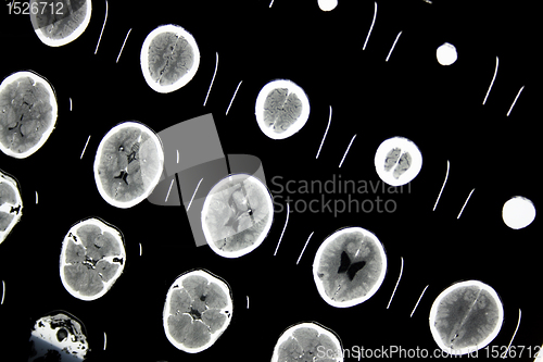 Image of Ct file