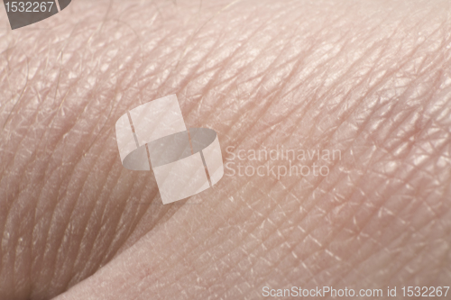 Image of human skin detail