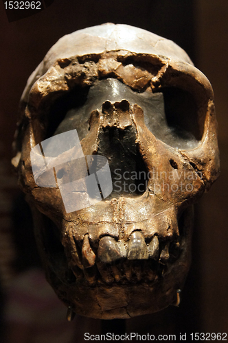 Image of Human skull