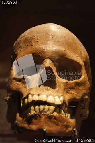 Image of Skull