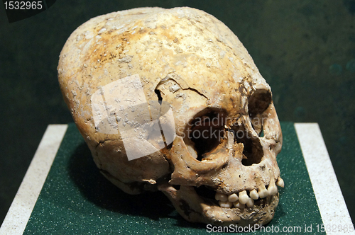 Image of Skull