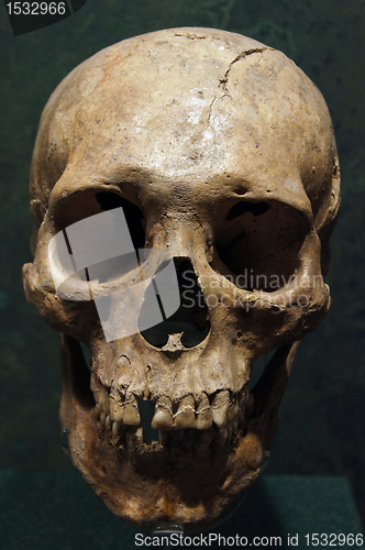 Image of Skull