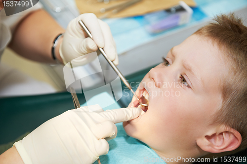 Image of dental examination of child
