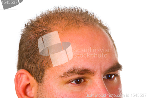 Image of Young man with hair problem