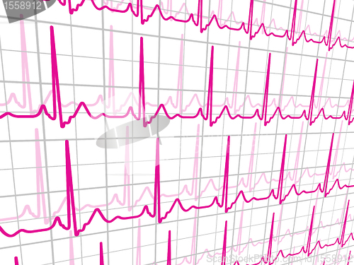 Image of Heart beats cardiogram. EPS 8