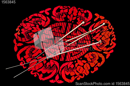 Image of acupuncture needle