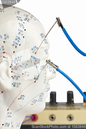 Image of electro-acupuncture