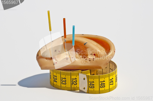 Image of acupuncture for weight loss