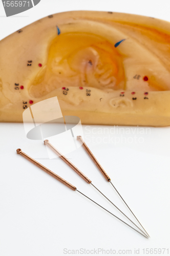 Image of acupuncture needle ear