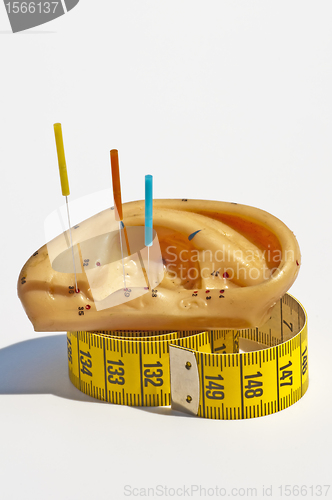 Image of acupuncture for weight loss