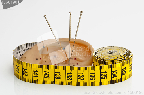 Image of acupuncture for weight loss