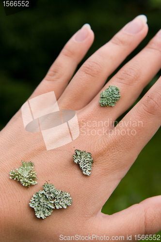 Image of lichen on the hand