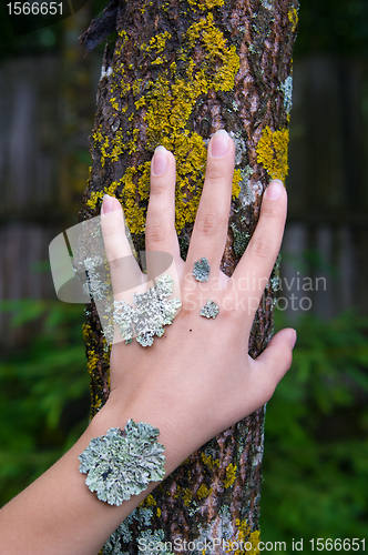 Image of lichen on the hand