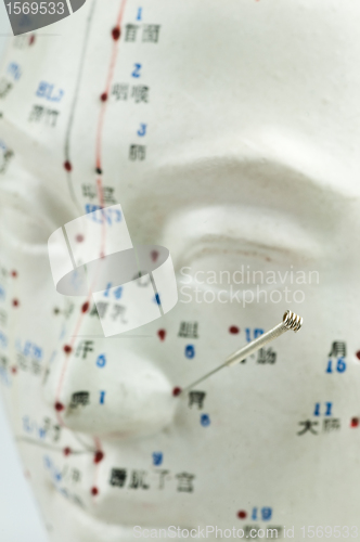 Image of Acupuncture needles on head model