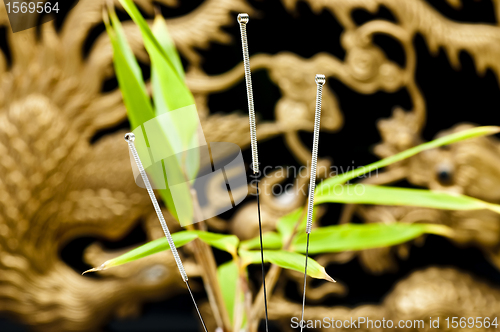 Image of acupuncture needles