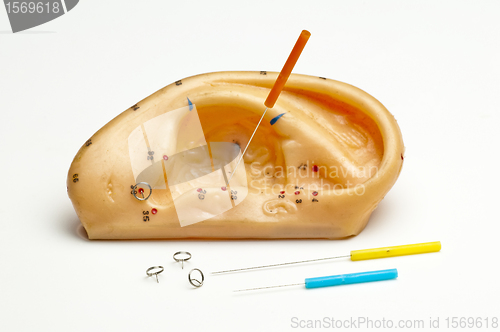 Image of acupuncture needle 