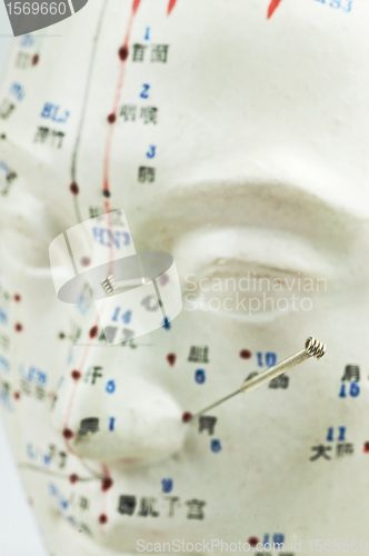 Image of Acupuncture needles on head model