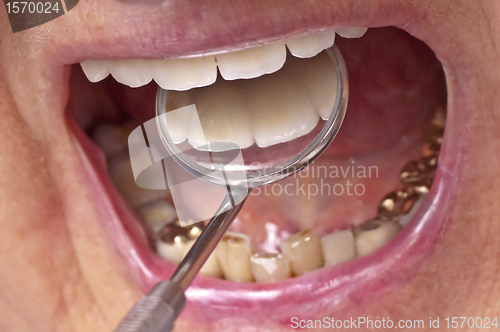 Image of teeth examination