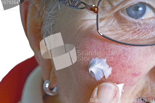 Image of pensioner with ointment