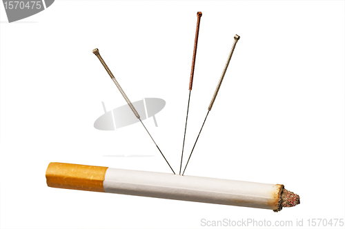 Image of acupuncture to stop smoking