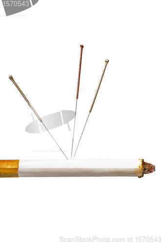 Image of acupuncture to stop smoking