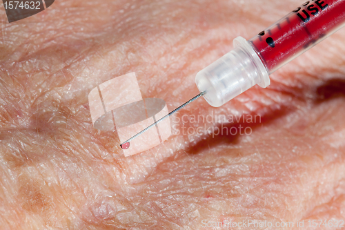 Image of Injection into hand of senior male