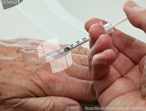Image of Injection into hand of senior male