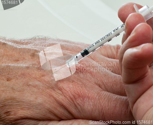 Image of Injection into hand of senior male