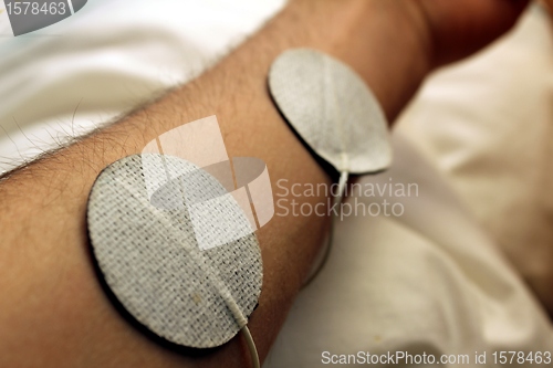 Image of transcutaneous electrical nerve stimulation device (tens)