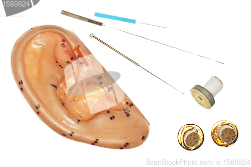 Image of ear acupuncture