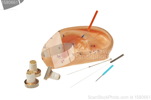 Image of ear acupuncture