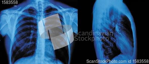 Image of X-Ray 