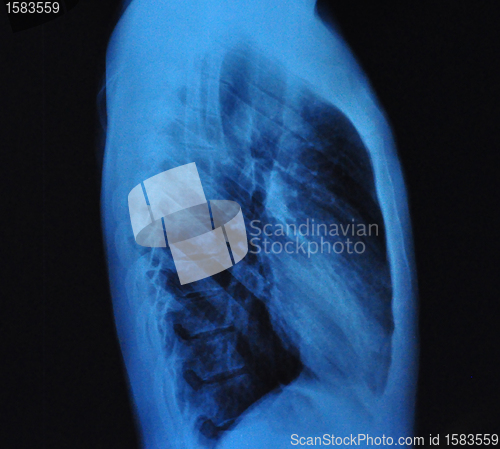 Image of X-Ray