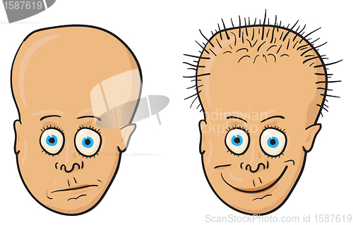 Image of Illustration - patient with a bald head and hair