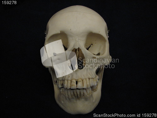 Image of Cranium, frontal view