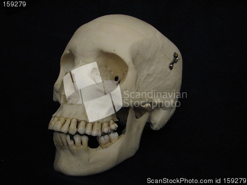 Image of Human cranium
