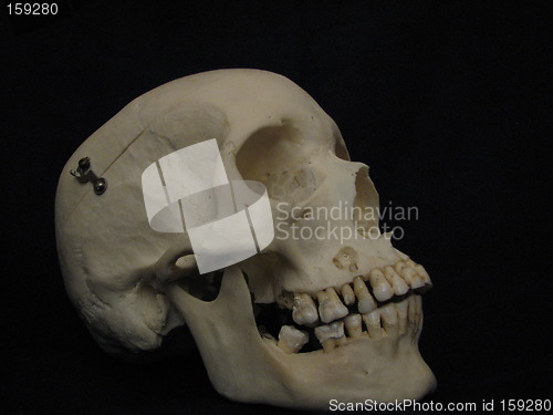 Image of Cranium, side view