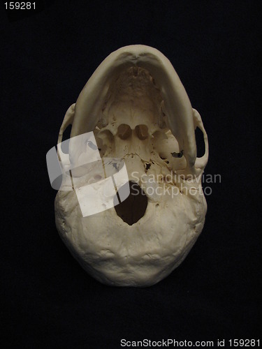 Image of Human skull, bottom view